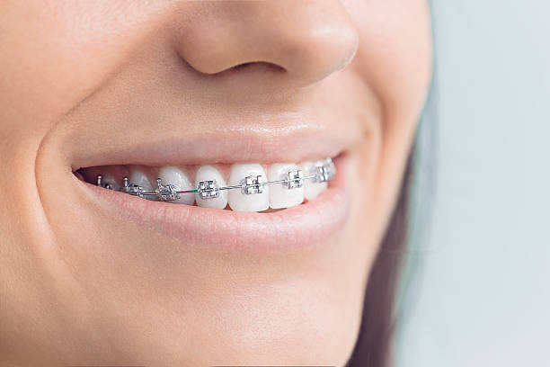 Best Teeth Whitening  in Wrightsville, PA